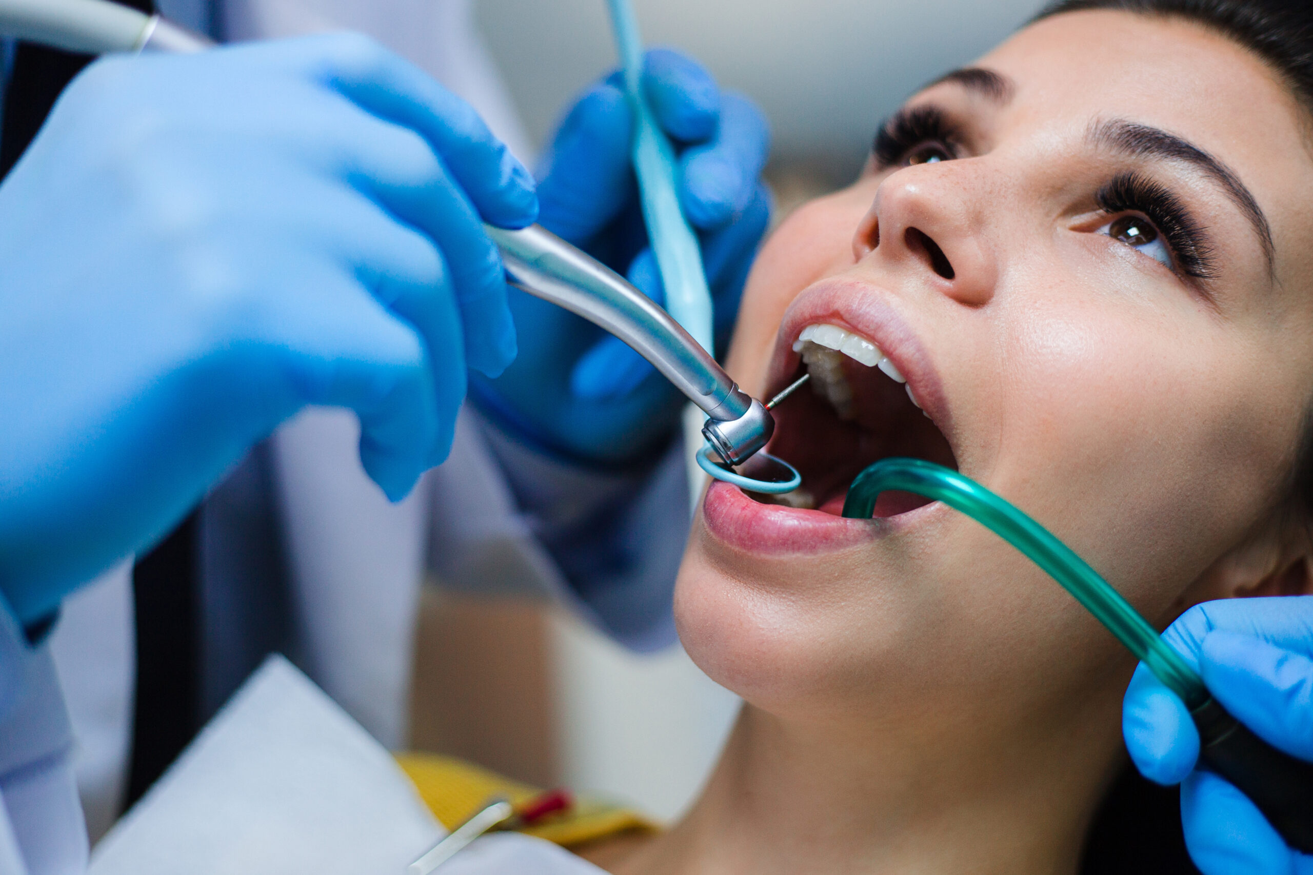 AdobeStock 226838750 scaled - SmilePro Dental