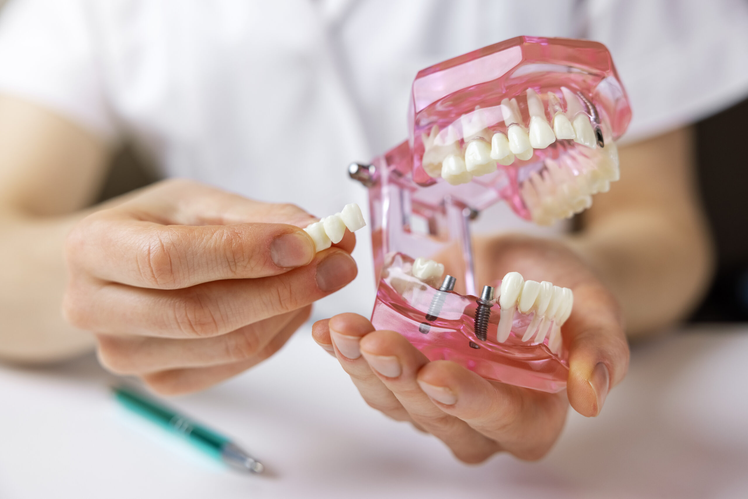 AdobeStock 397039380 scaled - SmilePro Dental